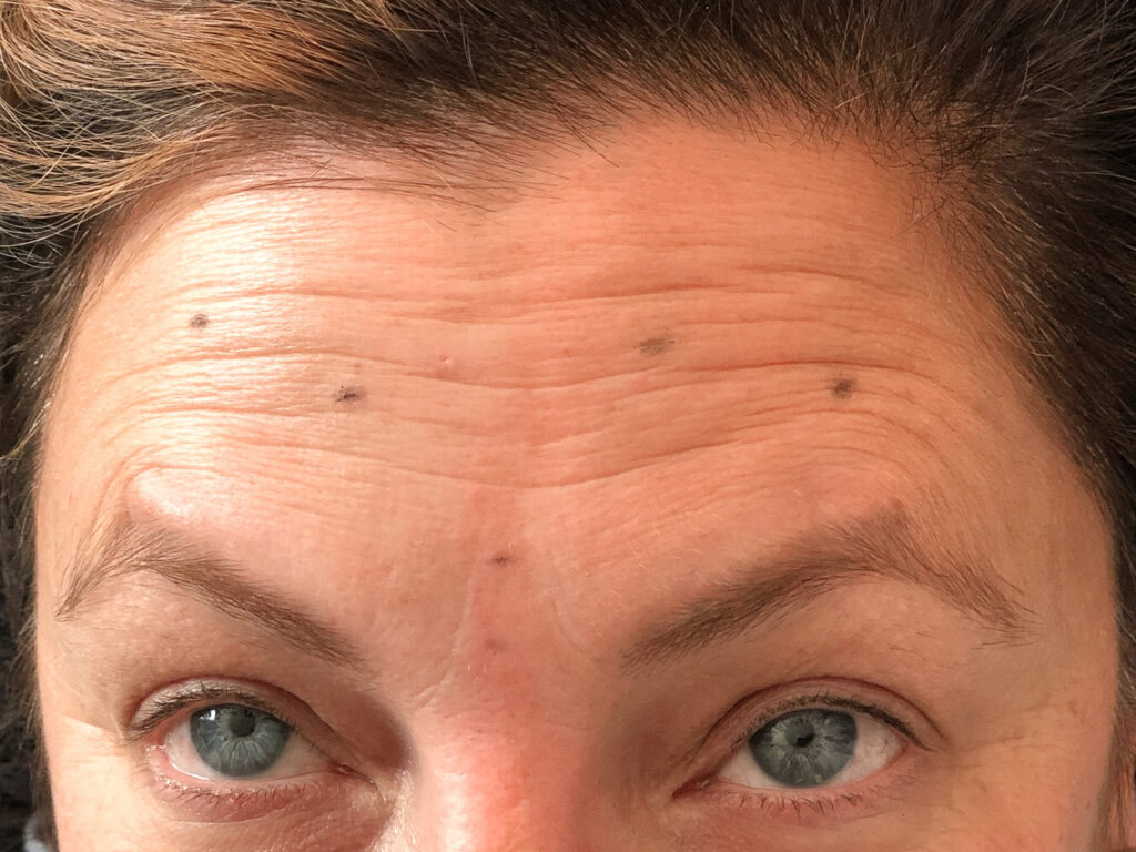 dotted forehead